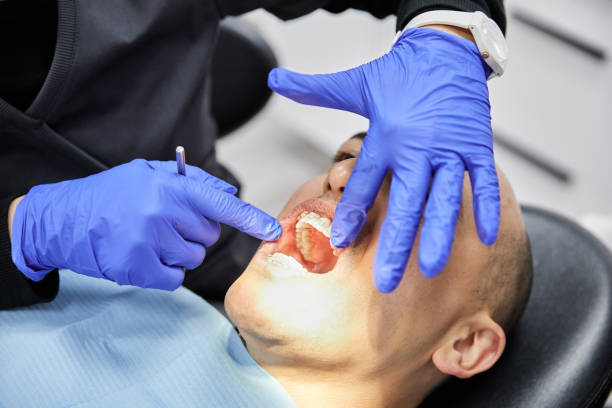 Best Emergency Dental Care for Sports Injuries in Sheboygan, WI